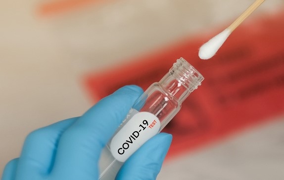 1087 са новите случаи на коронавирус показват актуализираните данни на